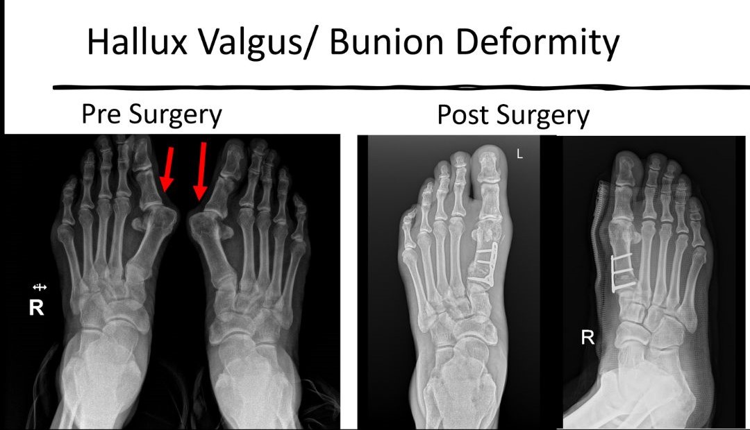 Foot and Ankle Treatment in Delhi | Dr. Yashwant Singh Tanwar